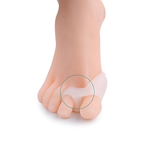 Which is the best splints for bunions on Amazon? : Product : MD News Daily